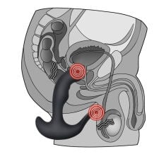 Prostatos masažuoklis P-spot Embracer 